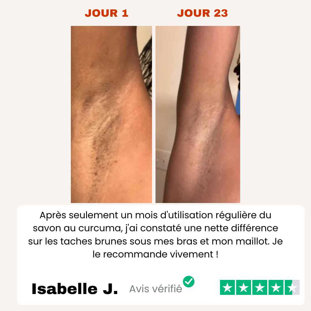 Savon Anti-Tâches Au Curcuma