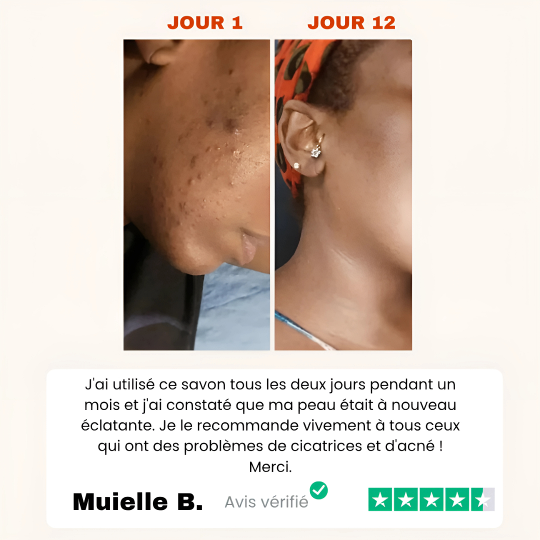 Savon Anti-Tâches Au Curcuma