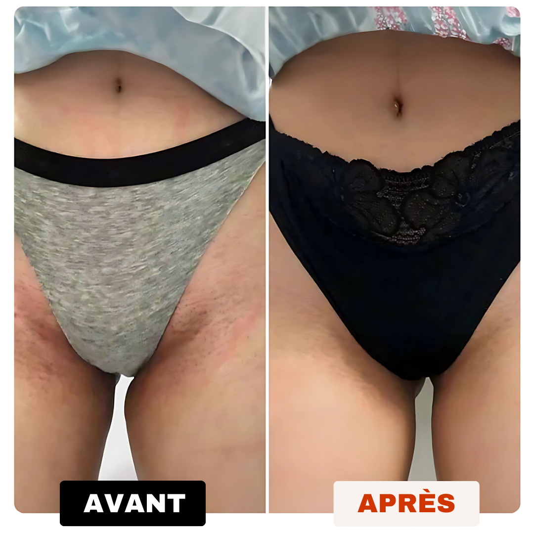 Savon Anti-Tâches Au Curcuma