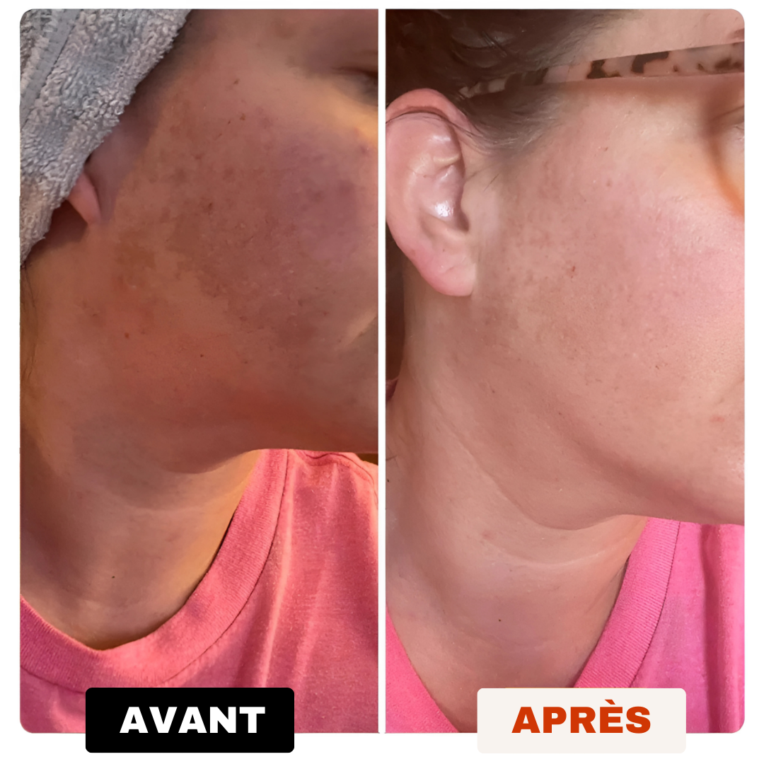 Savon Anti-Tâches Au Curcuma