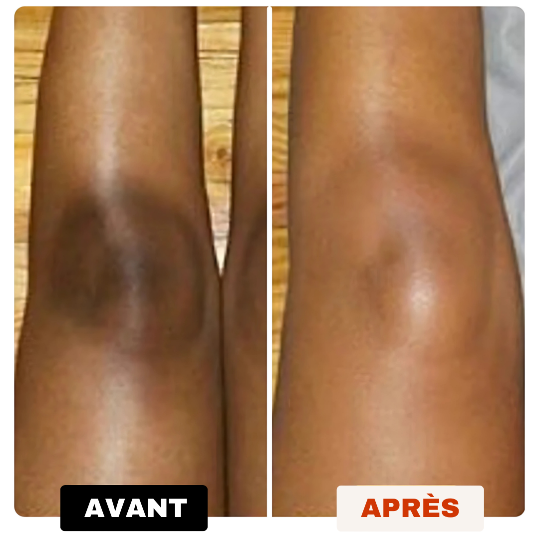 Savon Anti-Tâches Au Curcuma