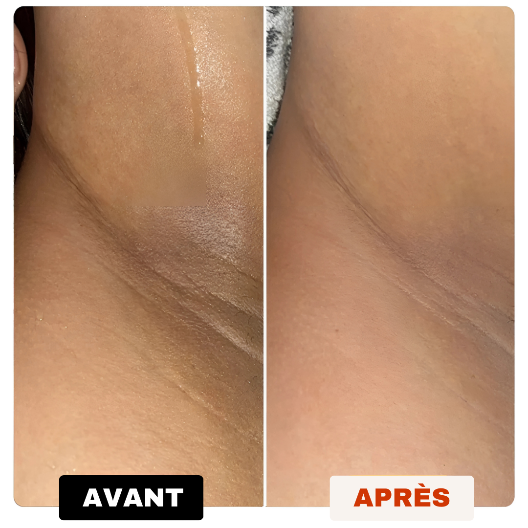 Savon Anti-Tâches Au Curcuma